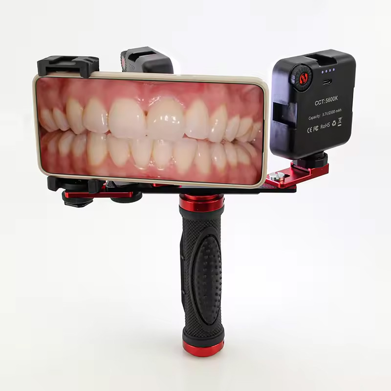 Photography Mobile Lighting - 歯科用モバイル写真撮影LEDライト 口腔内写真・ビデオ用フラッシュライト 照明器具 歯科医治療用ランプ